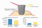 Comparison of the Effects of Er, Cr: YSGG Laser and Super-Saturated Citric Acid on the Debridement of Contaminated Implant Surfaces