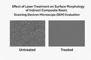 Effect of Laser Treatment on Surface Morphology of Indirect Composite Resin: Scanning Electron Microscope (SEM) Evaluation