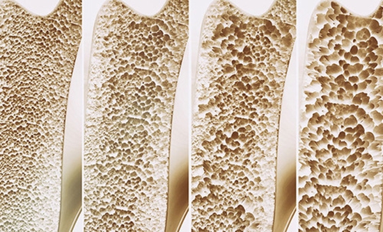  Bone Metabolism {faces}